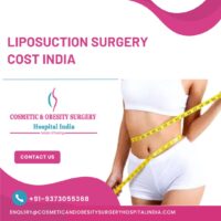Best Price for Liposuction In India