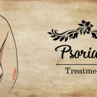 Best Psoriaisis Treatment in Kerala